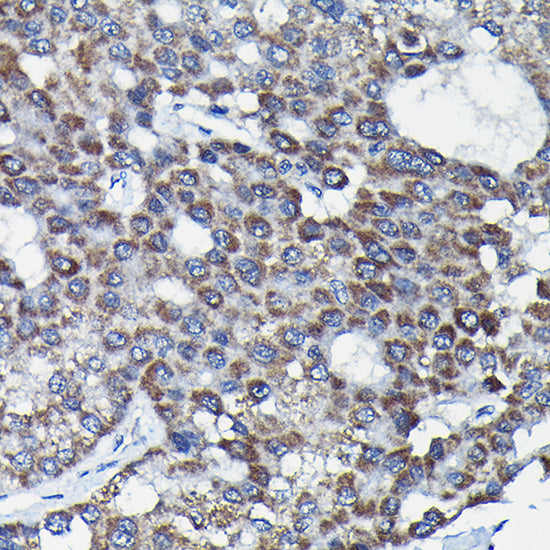 RGS14 Rabbit pAb
