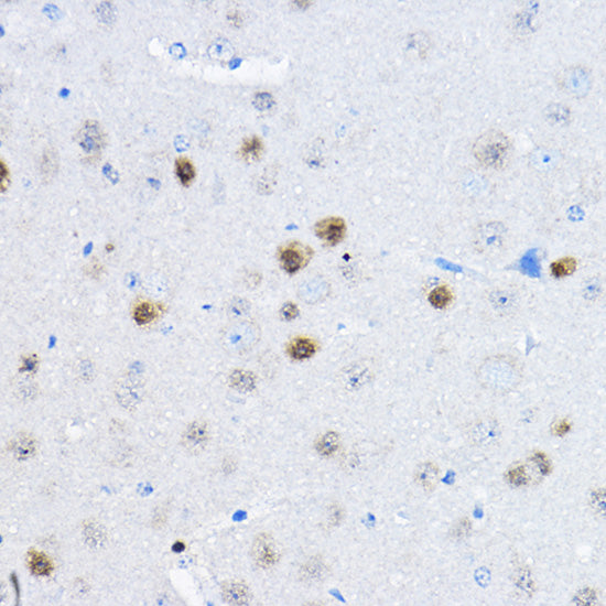 RPP25 Rabbit pAb