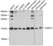 UQCC2 Rabbit pAb