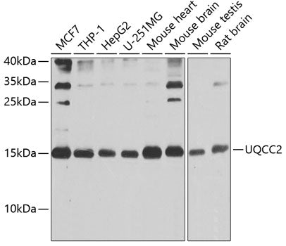UQCC2 Rabbit pAb