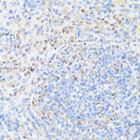 UQCC2 Rabbit pAb