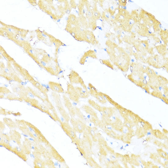 UQCC2 Rabbit pAb