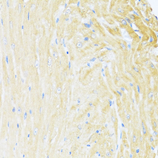 UQCC2 Rabbit pAb
