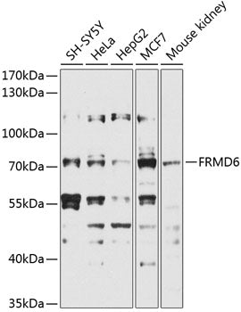 FRMD6 Rabbit pAb