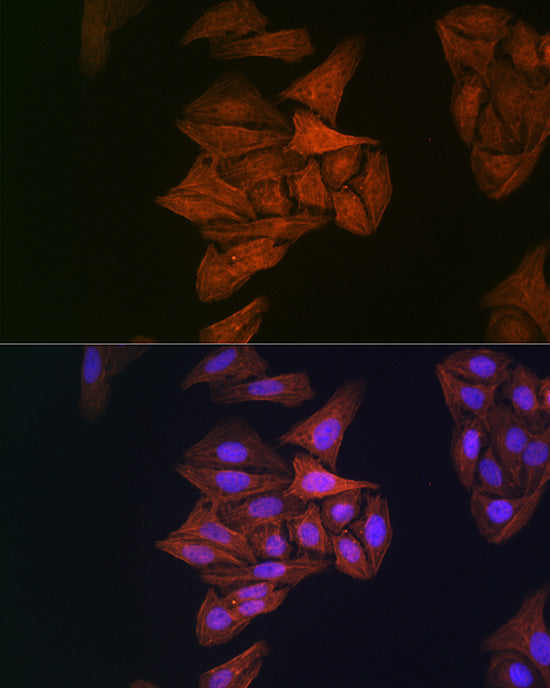 β-Actin Mouse mAb