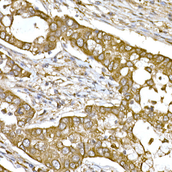 β-Tubulin Rabbit pAb