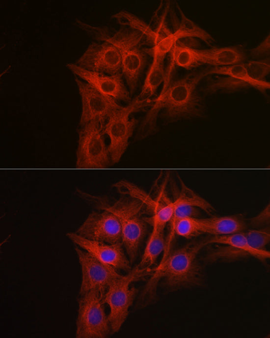 β-Tubulin Rabbit pAb