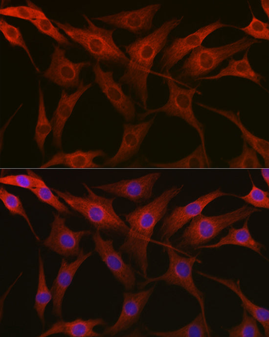β-Tubulin Rabbit pAb