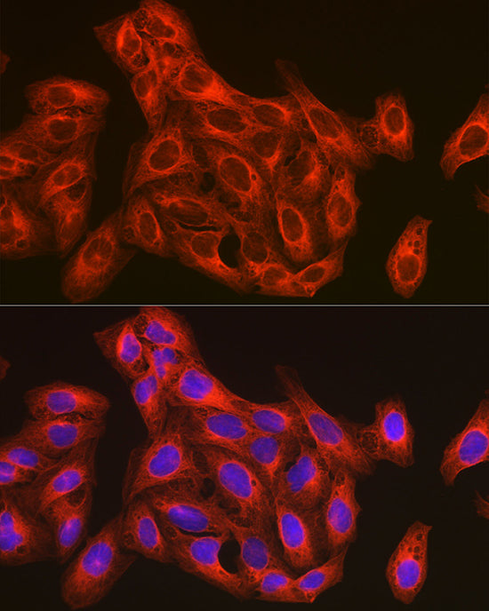 β-Tubulin Rabbit pAb