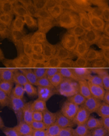 β-Tubulin Rabbit pAb