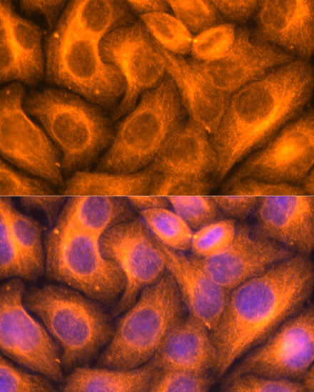 β-Tubulin Rabbit pAb