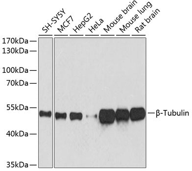 β-Tubulin Mouse mAb