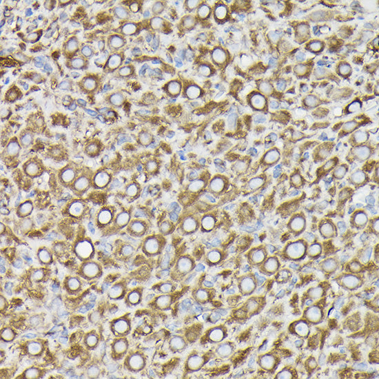 β-Tubulin Mouse mAb