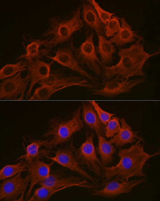 β-Tubulin Mouse mAb