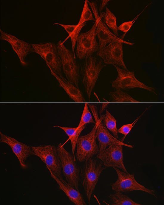 β-Tubulin Mouse mAb