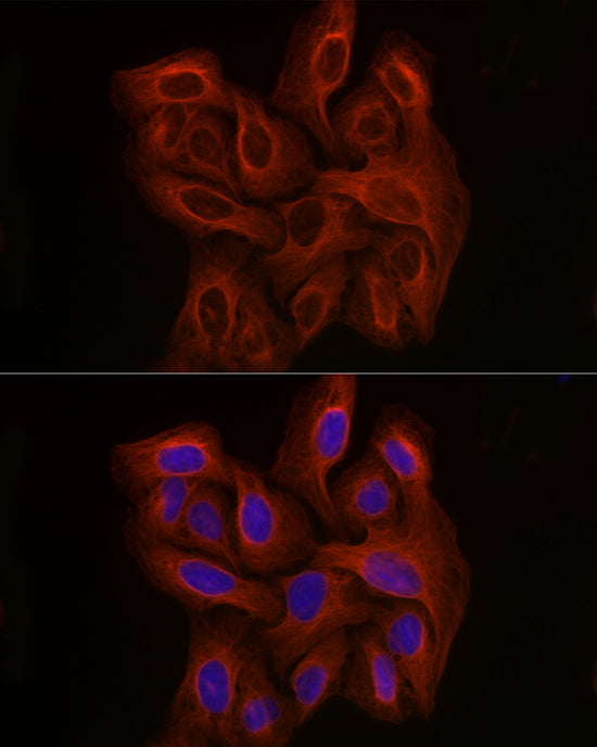 β-Tubulin Mouse mAb