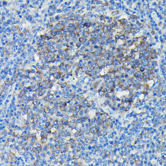 Alpha-tubulin (ubiquitous) chain Rabbit pAb