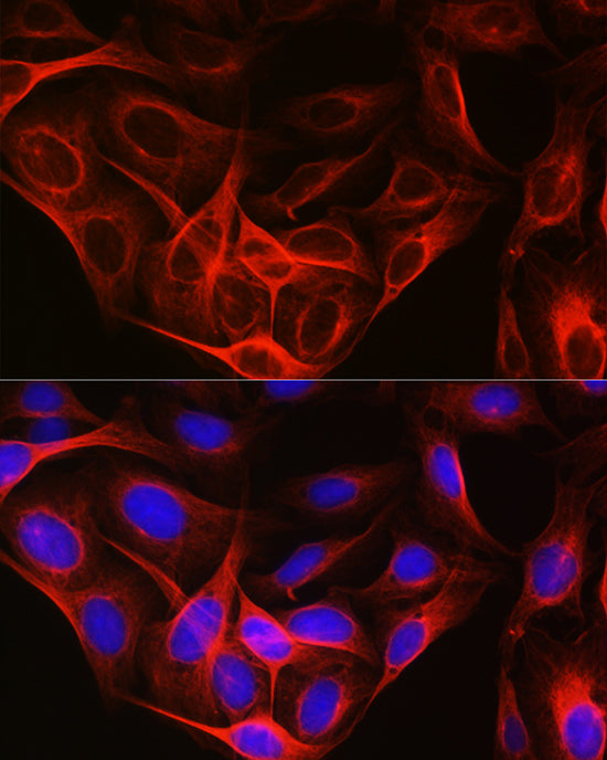 Alpha-tubulin (ubiquitous) chain Rabbit pAb