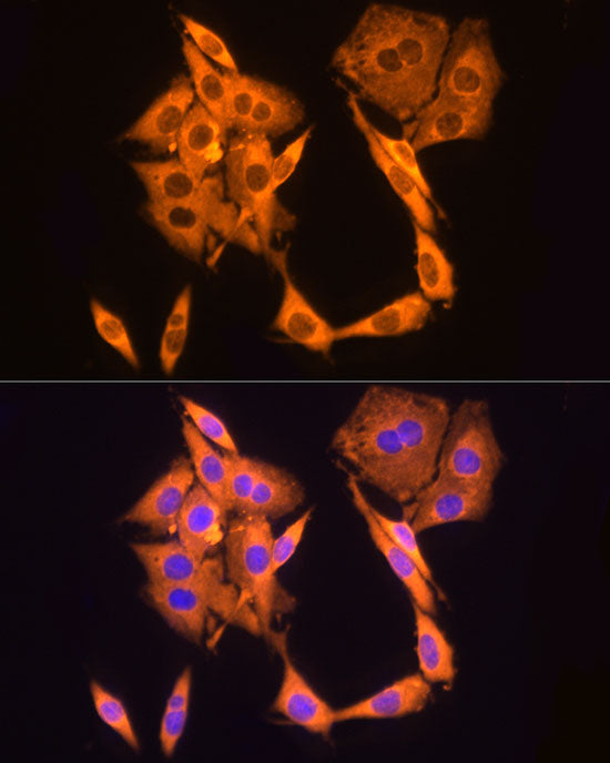 GAPDH Mouse mAb (High Dilution)