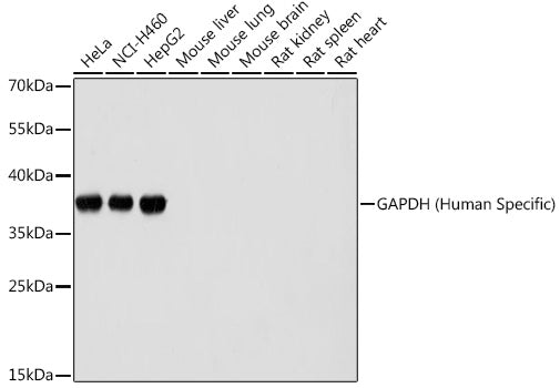 GAPDH (Human Specific)  Rabbit mAb