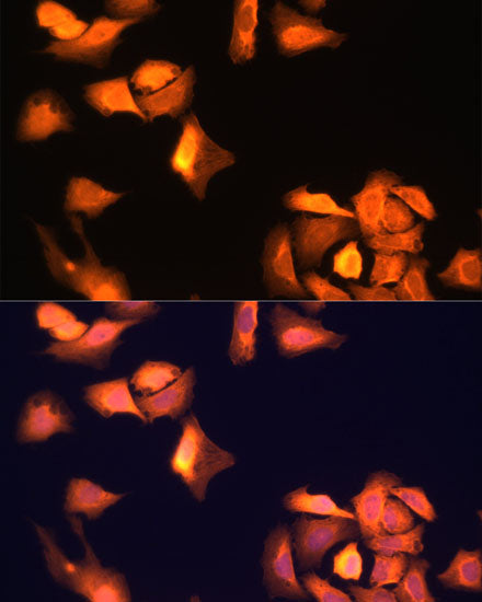 GAPDH (Human Specific)  Rabbit mAb