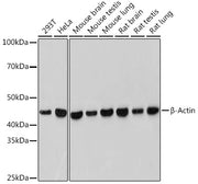 β-Actin Rabbit mAb