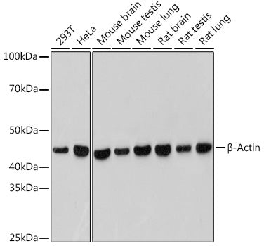 β-Actin Rabbit mAb