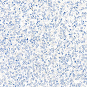 Rabbit IgG isotype control