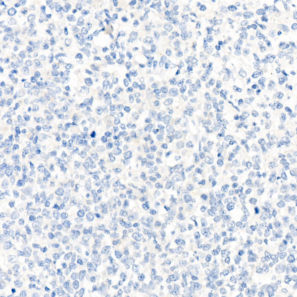 Rabbit IgG isotype control