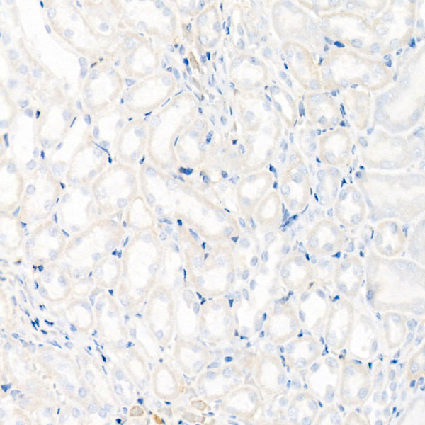 Rabbit IgG isotype control