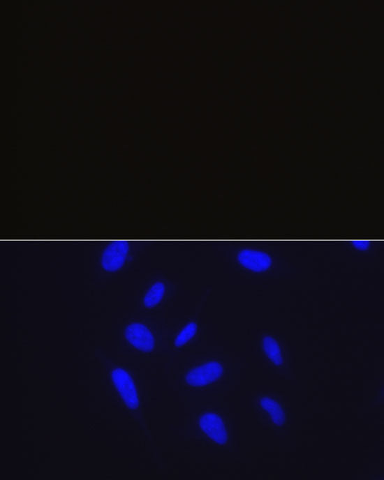 Rabbit IgG isotype control