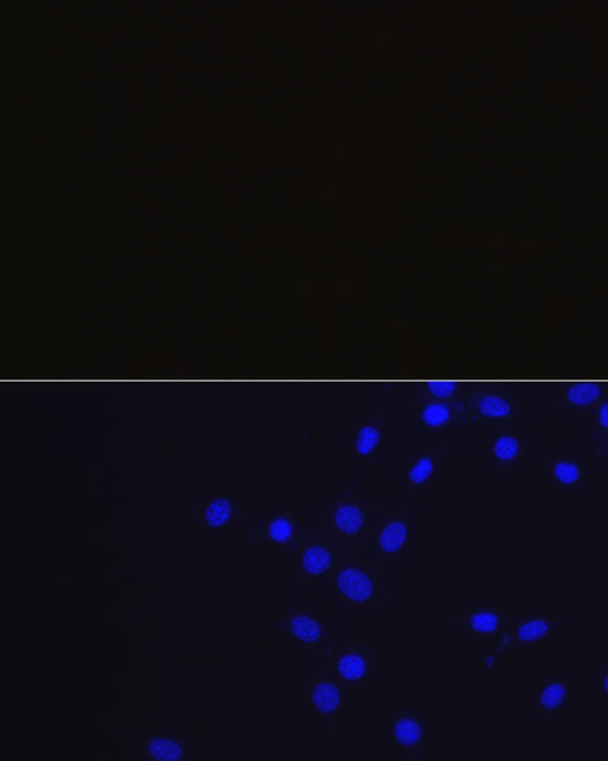 Rabbit IgG isotype control