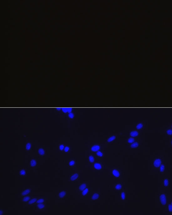 Rabbit IgG isotype control