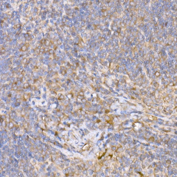 α-Tubulin Rabbit mAb