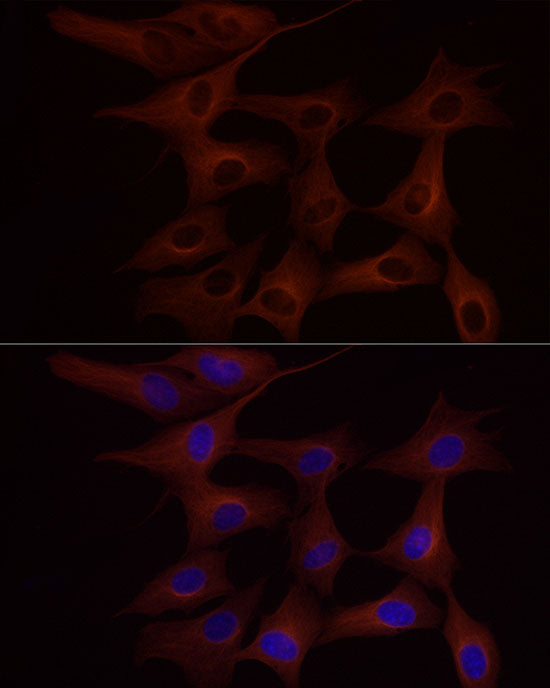 α-Tubulin Rabbit mAb
