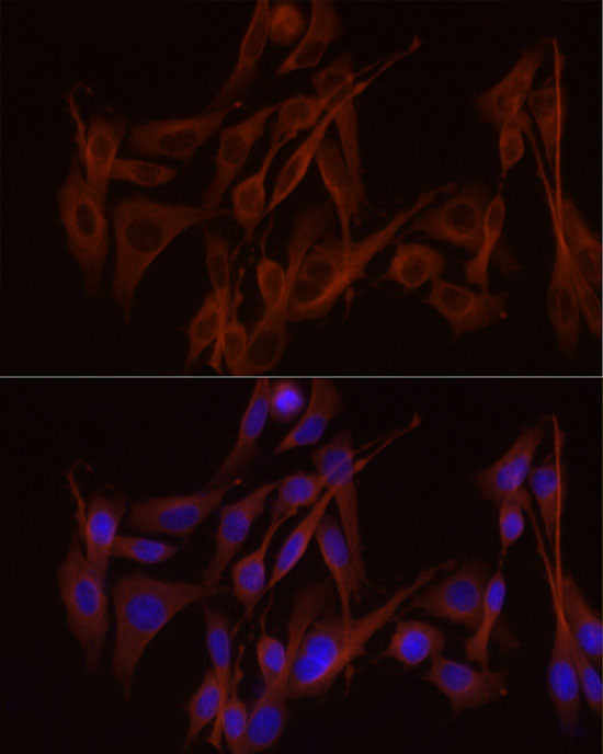 α-Tubulin Rabbit mAb