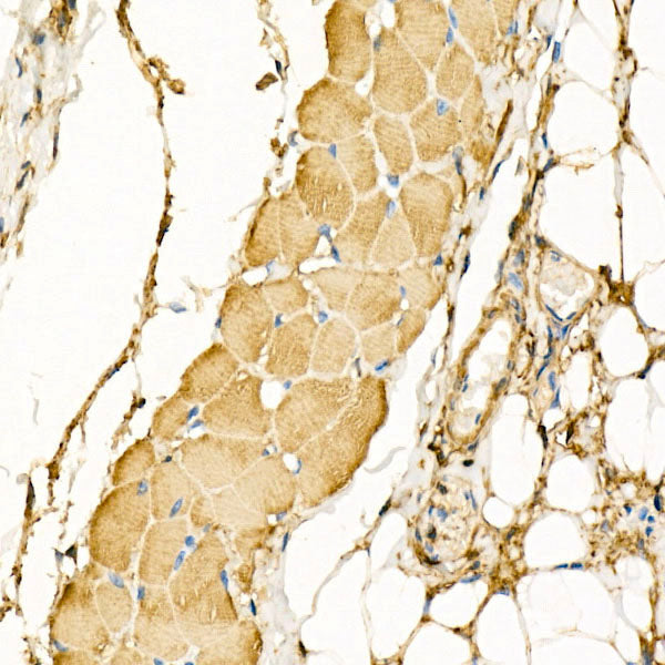 β-Actin Rabbit mAb