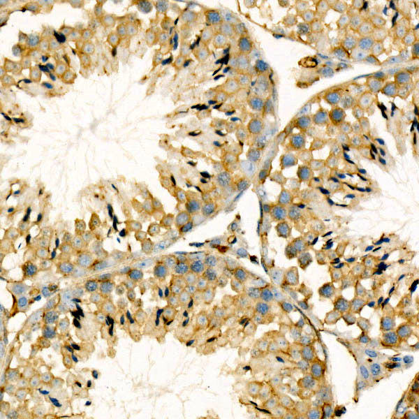 β-Actin Rabbit mAb