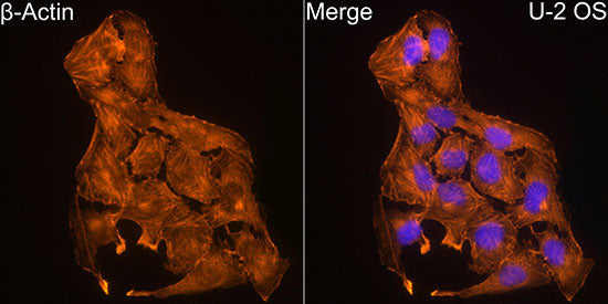 β-Actin Rabbit mAb