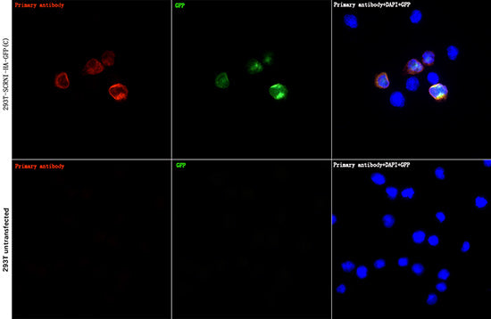 HA-Tag Rabbit mAb