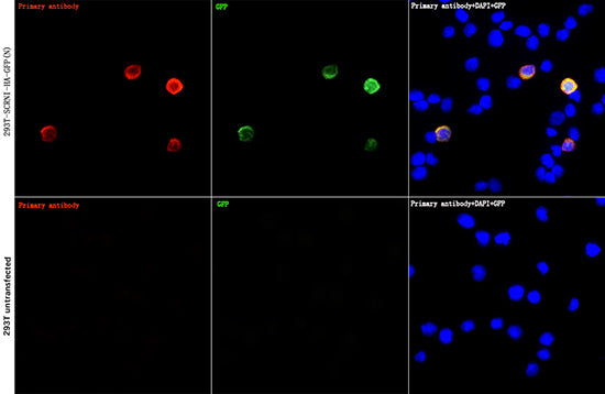 HA-Tag Rabbit mAb