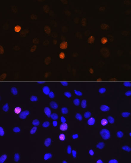 Phospho-Histone H3-S10 Rabbit mAb
