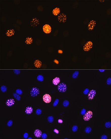 Phospho-Histone H3-S10 Rabbit mAb