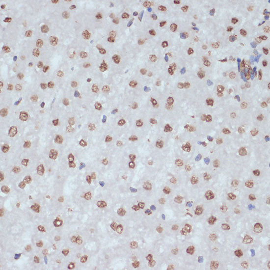 Phospho-CDK1-Y15 Rabbit pAb