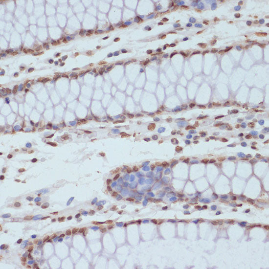 Phospho-CDK1-Y15 Rabbit pAb