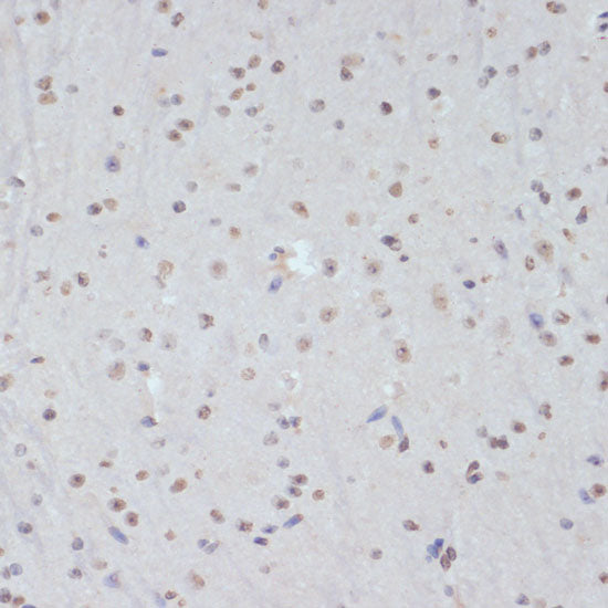 Phospho-CDK1-Y15 Rabbit pAb