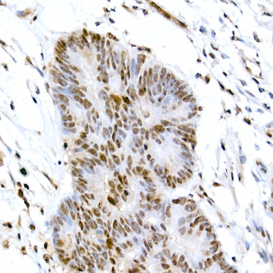 Phospho-CREB1-S133 Rabbit pAb
