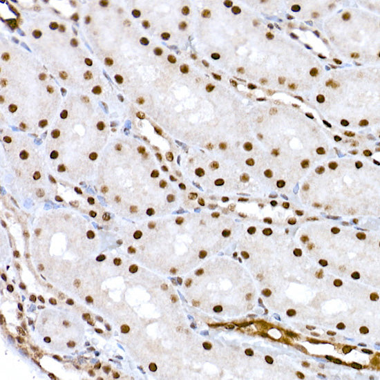 Phospho-CREB1-S133 Rabbit pAb