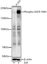 Phospho-EGFR-Y845 Rabbit pAb