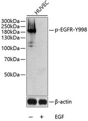Phospho-EGFR-Y998 Rabbit pAb
